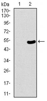 53BP1 Antibody in Western Blot (WB)