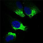 TWIST1 Antibody in Immunocytochemistry (ICC/IF)