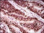 TWIST1 Antibody in Immunohistochemistry (Paraffin) (IHC (P))