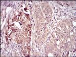 Villin Antibody in Immunohistochemistry (Paraffin) (IHC (P))