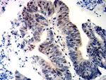 WT1 Antibody in Immunohistochemistry (Paraffin) (IHC (P))