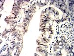 WT1 Antibody in Immunohistochemistry (Paraffin) (IHC (P))