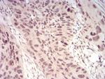 WTAP Antibody in Immunohistochemistry (Paraffin) (IHC (P))