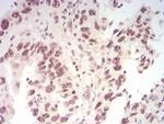 WTAP Antibody in Immunohistochemistry (Paraffin) (IHC (P))