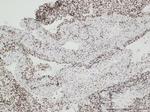 H3.3 G34W Antibody in Immunohistochemistry (IHC)