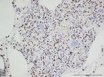 H3.3 G34W Antibody in Immunohistochemistry (IHC)