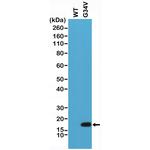 H3.3 G34V oncohistone mutant Antibody in Western Blot (WB)