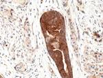 VEGF Antibody in Immunohistochemistry (Paraffin) (IHC (P))