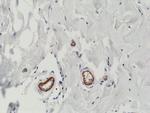 VEGF Antibody in Immunohistochemistry (Paraffin) (IHC (P))