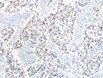 RNASEH2B Antibody in Immunohistochemistry (Paraffin) (IHC (P))