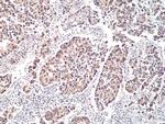 p70 S6 Kinase Antibody in Immunohistochemistry (Paraffin) (IHC (P))