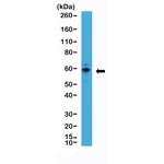 p70 S6 Kinase Antibody in Western Blot (WB)