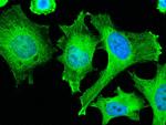 ADSL Antibody in Immunocytochemistry (ICC/IF)