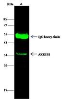 AKR1B1 Antibody in Immunoprecipitation (IP)