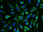 Arginase 1 Antibody in Immunocytochemistry (ICC/IF)