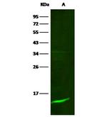 beta-2 Microglobulin Antibody in Western Blot (WB)