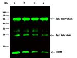beta-2 Microglobulin Antibody in Immunoprecipitation (IP)