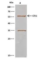 Carboxypeptidase M Antibody in Immunoprecipitation (IP)