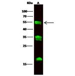 Carboxypeptidase M Antibody in Western Blot (WB)