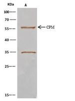 Carboxypeptidase M Antibody in Immunoprecipitation (IP)