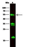 Carboxypeptidase M Antibody in Western Blot (WB)