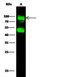 GNS Antibody in Western Blot (WB)