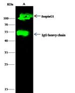 C1 inhibitor Antibody in Immunoprecipitation (IP)