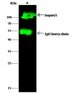 C1 inhibitor Antibody in Immunoprecipitation (IP)