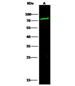 C1 inhibitor Antibody in Western Blot (WB)