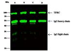 Transferrin Receptor Antibody in Immunoprecipitation (IP)