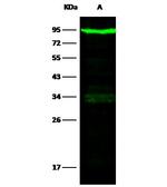 Transferrin Receptor Antibody in Western Blot (WB)