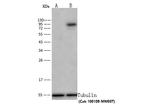 Transferrin Receptor Antibody in Western Blot (WB)