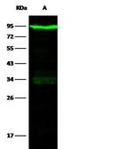 Transferrin Receptor Antibody in Western Blot (WB)