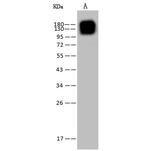 CD13 Antibody in Western Blot (WB)