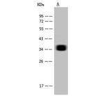 CD7 Antibody in Western Blot (WB)