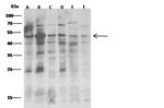 JNK2 Antibody in Western Blot (WB)