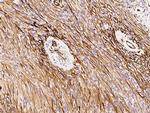 Nestin Antibody in Immunohistochemistry (Paraffin) (IHC (P))