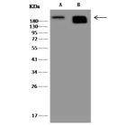 Nestin Antibody in Western Blot (WB)