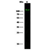 PDGFRA Antibody in Western Blot (WB)