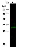 PRTFDC1 Antibody in Western Blot (WB)