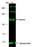 CD162 Antibody in Immunoprecipitation (IP)