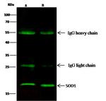 SOD1 Antibody in Immunoprecipitation (IP)