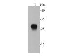 E tag Antibody in Western Blot (WB)