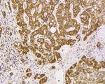 VDAC Antibody in Immunohistochemistry (Paraffin) (IHC (P))