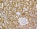 VDAC Antibody in Immunohistochemistry (Paraffin) (IHC (P))