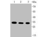 VDAC Antibody in Western Blot (WB)