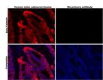 beta Catenin Antibody in Immunohistochemistry (Paraffin) (IHC (P))