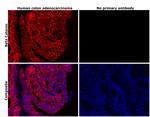 beta Catenin Antibody in Immunohistochemistry (Paraffin) (IHC (P))