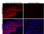 beta Catenin Antibody in Immunohistochemistry (Paraffin) (IHC (P))