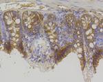 beta Catenin Antibody in Immunohistochemistry (Paraffin) (IHC (P))